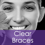 Dentist in Manchester offering Clear Braces
